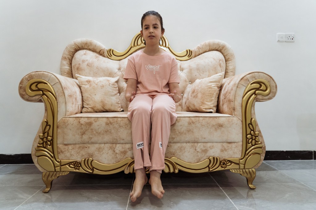 The war’s toll is inscribed on Fatema’s body. Born with severe deformities in her arms and legs, she embodies Fallujah’s toxic legacy—one of many children afflicted by conditions that families and experts trace to heavy metals left behind after the 2004 US assaults. Photo by Jaclynn Ashly.